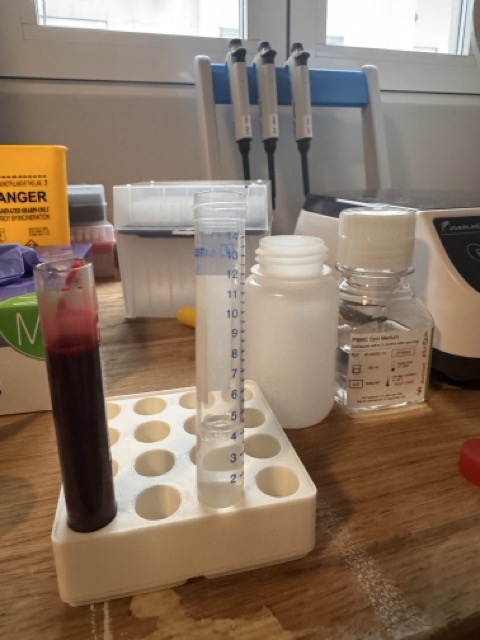 Preparing the PBMC density gradient tube